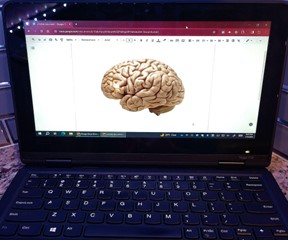 A brain on a computer symbolizing BCIs. 